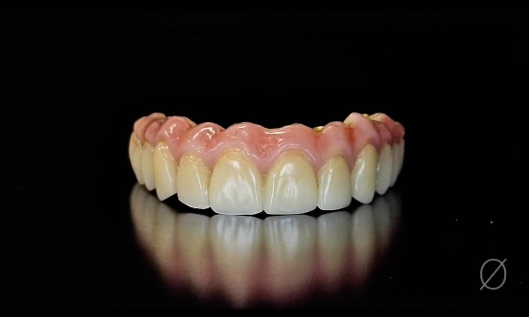 Arcade prothétique complète avec céramique rose et dents stratifiées